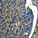 CFL1 Antibody in Immunohistochemistry (Paraffin) (IHC (P))