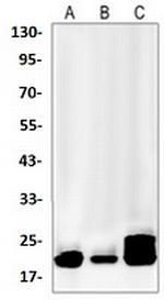 CFL1 Antibody in Western Blot (WB)