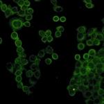 COL1A1 Antibody in Immunocytochemistry (ICC/IF)