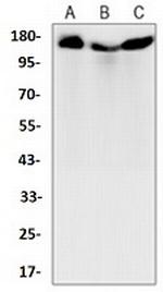 COL1A1 Antibody in Western Blot (WB)