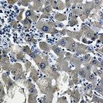 CYP2D6 Antibody in Immunohistochemistry (Paraffin) (IHC (P))
