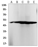 CYP2D6 Antibody in Western Blot (WB)