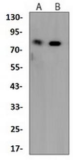 DGKA Antibody in Western Blot (WB)