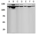 DGKZ Recombinant Rabbit Monoclonal Antibody