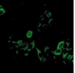 KIF11 Recombinant Rabbit Monoclonal Antibody