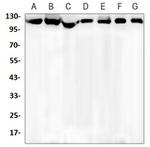 KIF11 Antibody in Western Blot (WB)