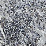 EIF4B Recombinant Rabbit Monoclonal Antibody