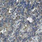 HSP90AB1 Recombinant Rabbit Monoclonal Antibody