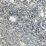 IL26 Antibody in Immunohistochemistry (Paraffin) (IHC (P))