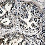 IMPDH2 Antibody in Immunohistochemistry (Paraffin) (IHC (P))