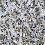 KEAP1 Recombinant Rabbit Monoclonal Antibody