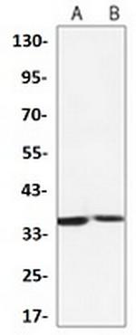 L1RE1 Recombinant Rabbit Monoclonal Antibody