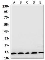 MAP1LC3A Recombinant Rabbit Monoclonal Antibody