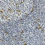 MERTK Recombinant Rabbit Monoclonal Antibody