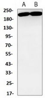 MERTK Antibody in Western Blot (WB)