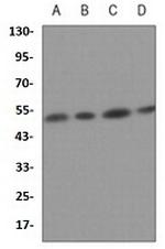 P2RY12 Antibody in Western Blot (WB)