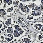 PHB1 Antibody in Immunohistochemistry (Paraffin) (IHC (P))