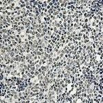 PTBP1 Antibody in Immunohistochemistry (Paraffin) (IHC (P))