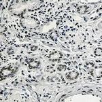 RAD21 Antibody in Immunohistochemistry (Paraffin) (IHC (P))
