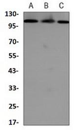 RAD21 Antibody in Western Blot (WB)