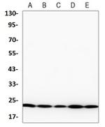 NRAS Recombinant Rabbit Monoclonal Antibody