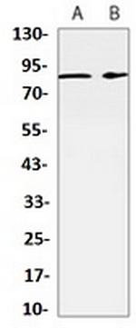 RPS6KA3 Antibody in Western Blot (WB)