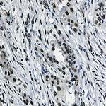 SF3B1 Antibody in Immunohistochemistry (Paraffin) (IHC (P))
