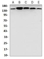 SF3B1 Antibody in Western Blot (WB)