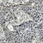 SMARCA2 Antibody in Immunohistochemistry (Paraffin) (IHC (P))