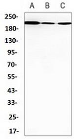 SMARCA2 Antibody in Western Blot (WB)