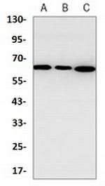 SQSTM1 Antibody in Western Blot (WB)