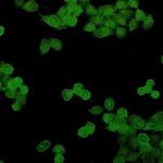 STAT5B Recombinant Rabbit Monoclonal Antibody