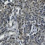STAT5B Antibody in Immunohistochemistry (Paraffin) (IHC (P))