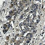 SOD1 Antibody in Immunohistochemistry (Paraffin) (IHC (P))