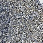 UBE2I Antibody in Immunohistochemistry (Paraffin) (IHC (P))