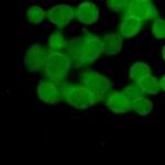 UBB Recombinant Rabbit Monoclonal Antibody