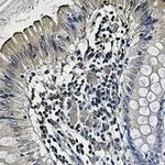 UBB Antibody in Immunohistochemistry (Paraffin) (IHC (P))