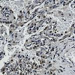 NAMPT Antibody in Immunohistochemistry (Paraffin) (IHC (P))