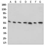 NAMPT Antibody in Western Blot (WB)