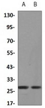 XBP1 Recombinant Rabbit Monoclonal Antibody