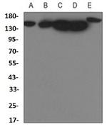 YTHDC2 Recombinant Rabbit Monoclonal Antibody