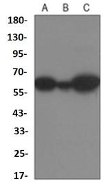 YTHDF1 Antibody in Western Blot (WB)