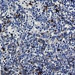 PRKCB Antibody in Immunohistochemistry (Paraffin) (IHC (P))