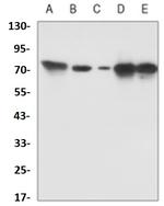 PRKCB Antibody in Western Blot (WB)