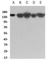 KDM4A Recombinant Rabbit Monoclonal Antibody