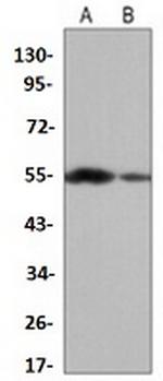 ALDH1A1 Antibody in Western Blot (WB)
