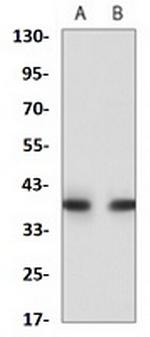 HLA-A Antibody in Western Blot (WB)