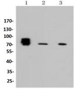 ALPL Antibody in Western Blot (WB)