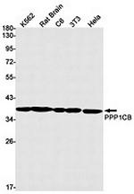 PPP1CB Antibody in Western Blot (WB)