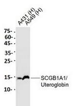 SCGB1A1 Recombinant Rabbit Monoclonal Antibody